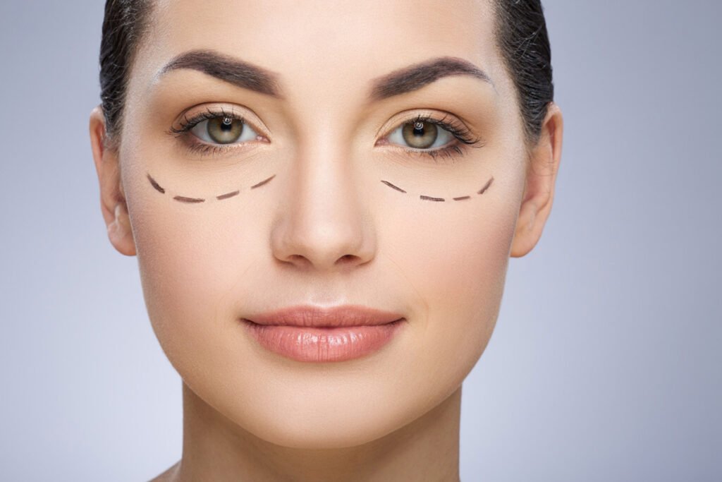 blefaroplastia-Instituto-de-Cirugia-Estetica