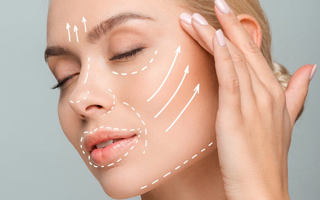 cirugia-lifting-facial-en-tijuana