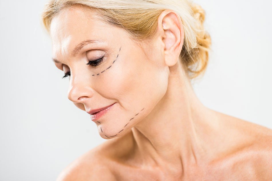 cirugia-lifting-facial-tijuana